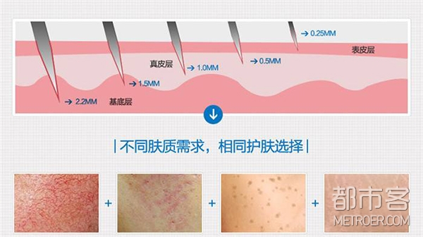 医美全攻略 | 我的ID是江南美人,你最想做的整形是?