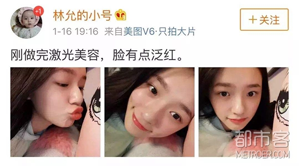 医美全攻略 | 我的ID是江南美人,你最想做的整形是?