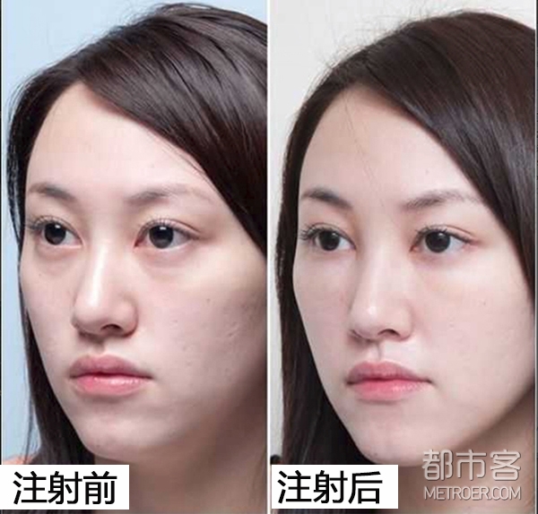医美颜习社 | 拒绝网红范儿,向“高级脸”进阶!