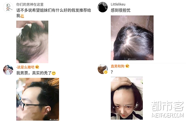 颜值加油站 | 植发太太太贵了?别怕还有拯救秃头少女的防“脱”指南